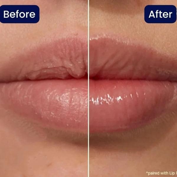 VITAMIN E LIP PLUMPING SERUM SOFORTIGE LIPPENFÜLLUNG 